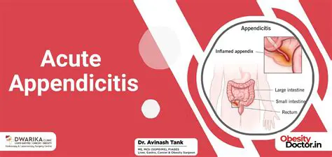 acute appendicitis is a medical emergency that requires immediate treatment