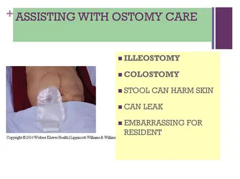 Assisting with Ostomy Care