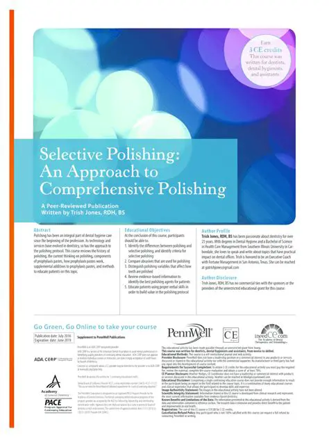 Benefits of Selective Polishing