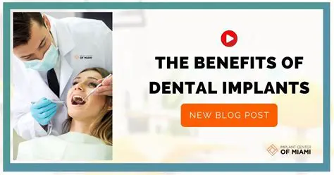 Benefits of Using Loadparts