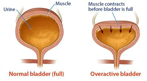 Bladder muscle overactivity