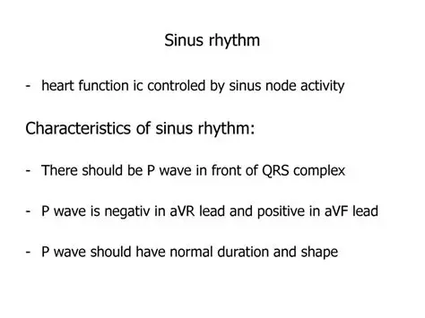 Characteristics of Sinus Rhythm