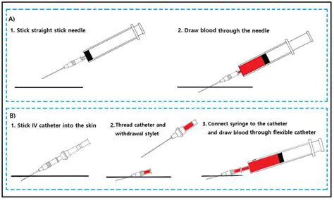 Contamination of the needle