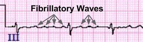 Continuous Fibrillatory Waves