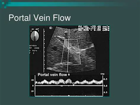 Decreased Portal Vein Flow