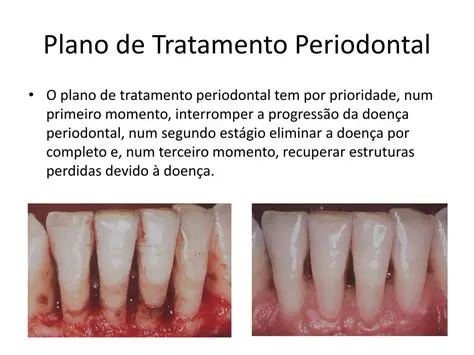Desenvolvimento de um plano de tratamento