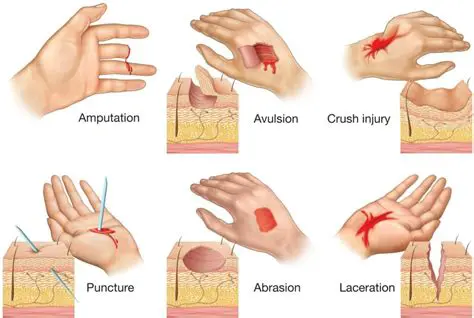 Distinguishing Abrasions from Other Wounds