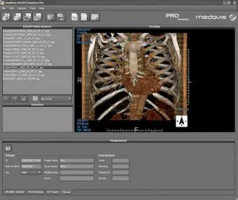 Features of medavis DICOM Importer Pro