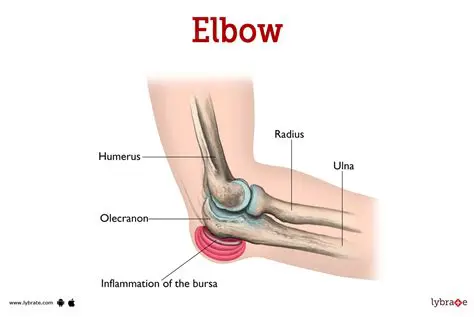 Frequently Asked Questions About the Bony Tip of the Elbow
