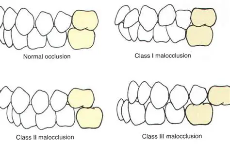Frequently Asked Questions about the Relationship between Maloklusi and Caries
