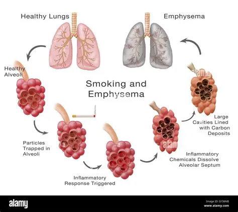 How Smoking Damages the Respiratory System