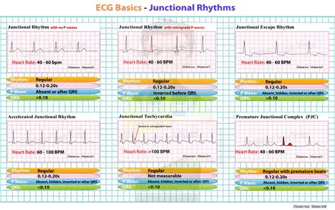 Identifying the Current Cardiac Rhythm