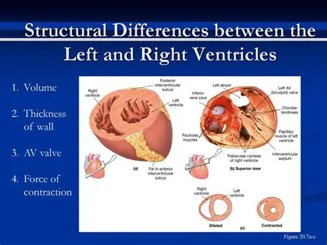 Identifying the Right Ventricle Wall