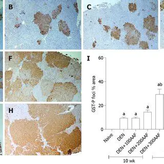 immunohistochemical examination using CD 10 antibodies