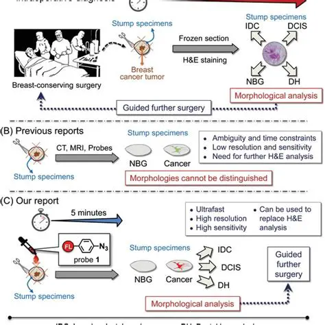 Imprin cytology can be used as a reliable method for intraoperative diagnosis