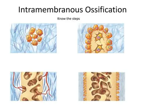 Intramembranous Ossification