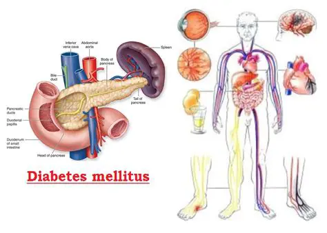 Introduction to Diabetes Mellitus
