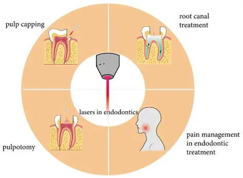 Introduction to Endodontic Treatments and the Importance of Endodontic Sealers