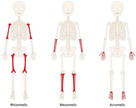 Invalid or Malformed Response