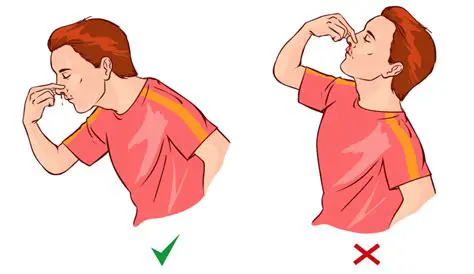 Kanama Durumunda Soru ve Cevaplar