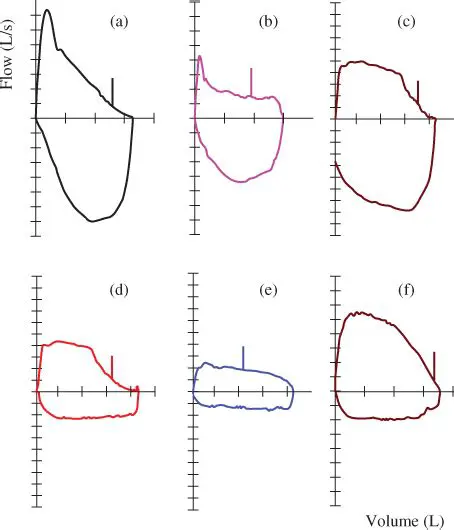 Key Concepts in Spirometry
