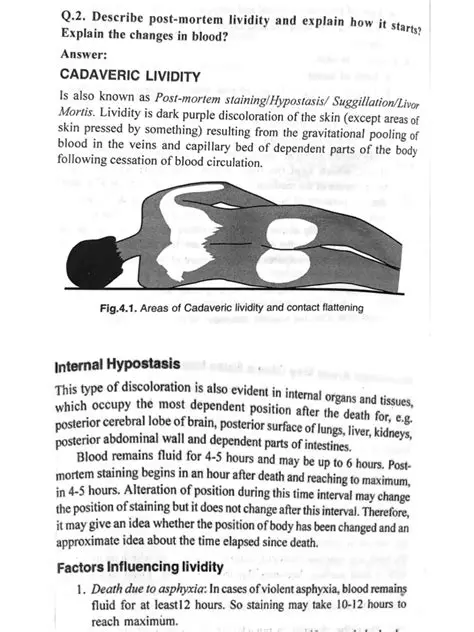 Lividity and Its Significance