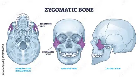 Location of the Zygomatic Bone