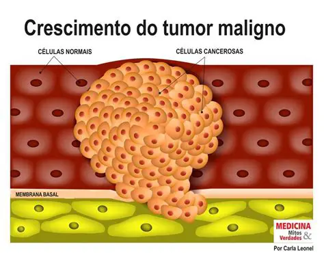 Modelagem de crescimento de tumores