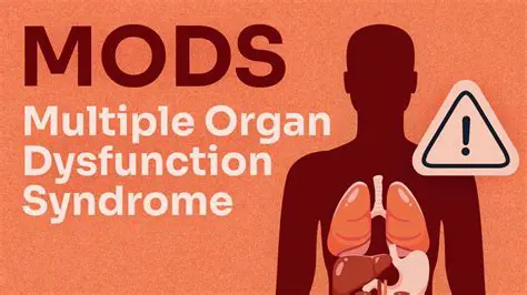 Multiple organ dysfunction