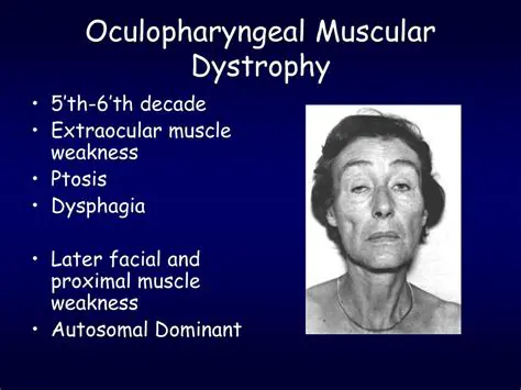 Oculopharyngeal muscular dystrophy