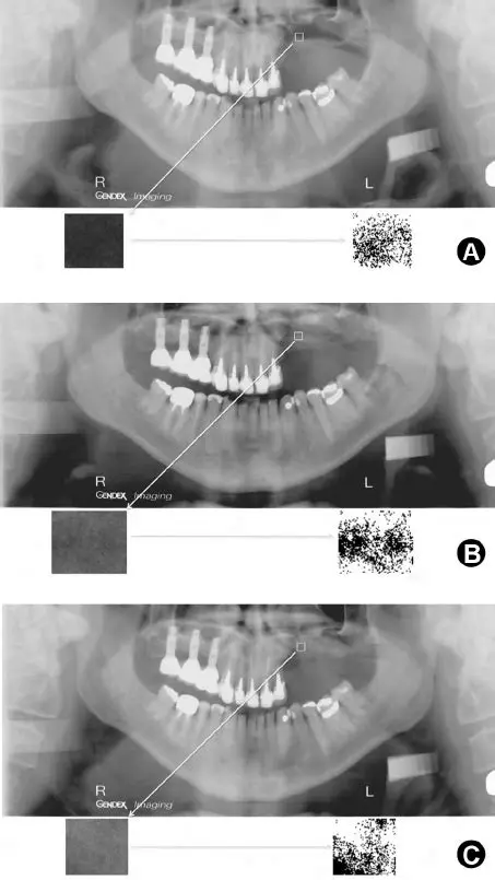 Panoramic radiographic examination