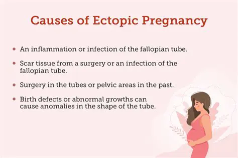 Previous ectopic pregnancy