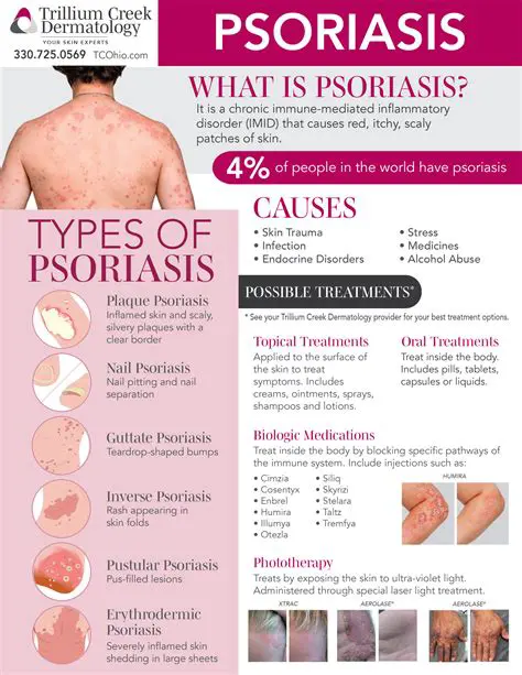 Psoriasis Treatment UK: Latest Advances and Comprehensive Guide