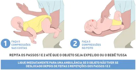 Qualquer pessoa pode realizar a manobra de Heimlich