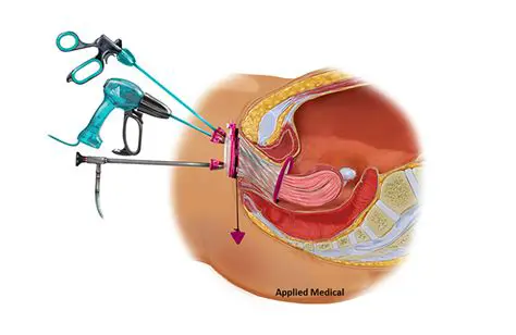 Shorter operation duration