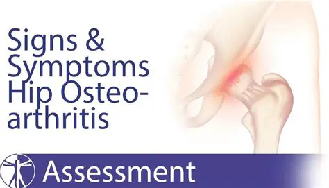 Sinais e Sintomas da Osteoartrite