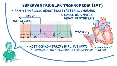Supraventricular tachycardia