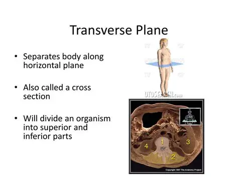 Synonyms for the Transverse Plane