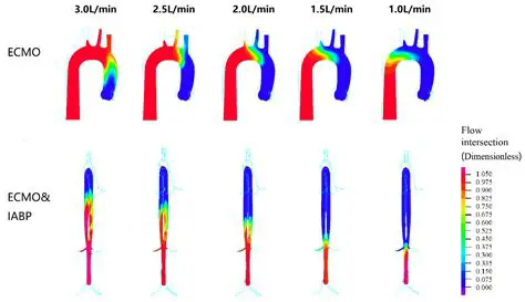 The Effects of Arterial Occlusion on Blood Flow