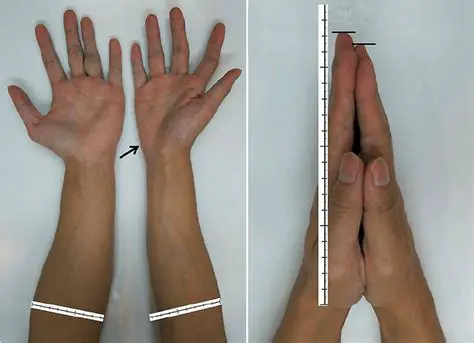 The Effects of Muscle Atrophy on Strength and Endurance