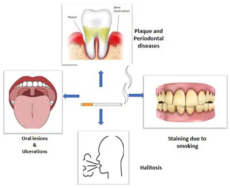 The Impact of Smoking on Periodontal Disease