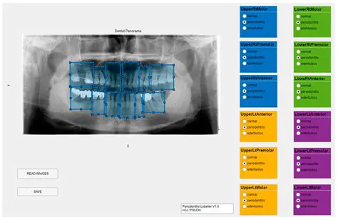 The Importance of Accurate Calculations in Radiography