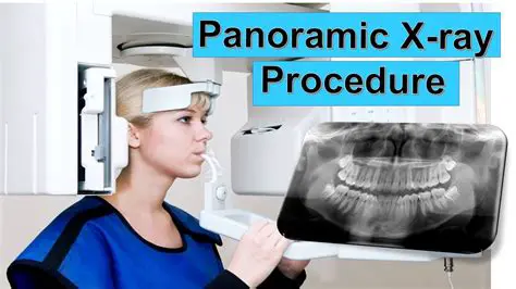 The Importance of Panoramic Radiography in Dentistry