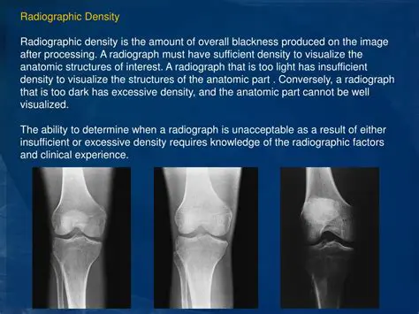 The Importance of Radiographic Image Sharpness