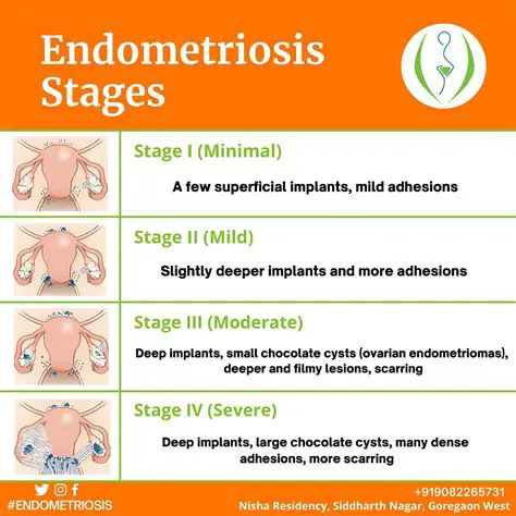The Importance of Rantes in Endometriosis