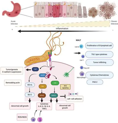 The Role of Helicobacter Pylori in Gastric Cancer Development