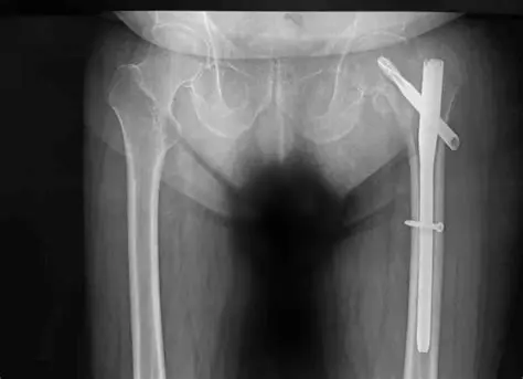 Total de Clavos en Inventario