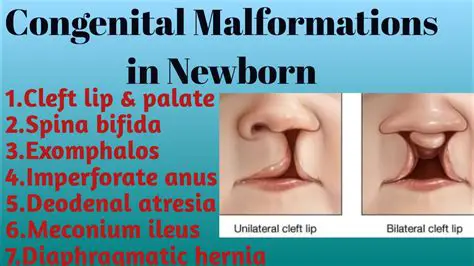 Types of Congenital Malformations