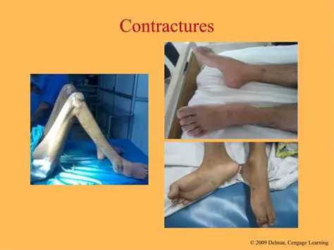 Understanding Contractures