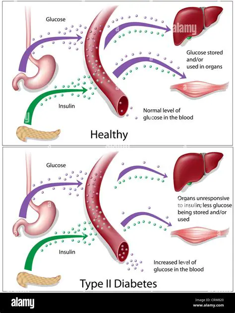 Understanding Diabetes Mellitus and Gangrene